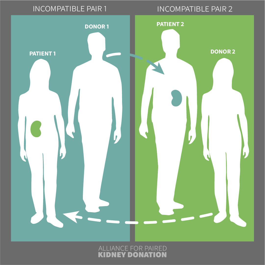 the-lifesaving-process-of-paired-kidney-donation-alliance-for-paired-kidney-donation